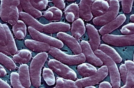 The Bayou State Records Five Fatalities from Necrotizing Bacterium in Gulf Waters